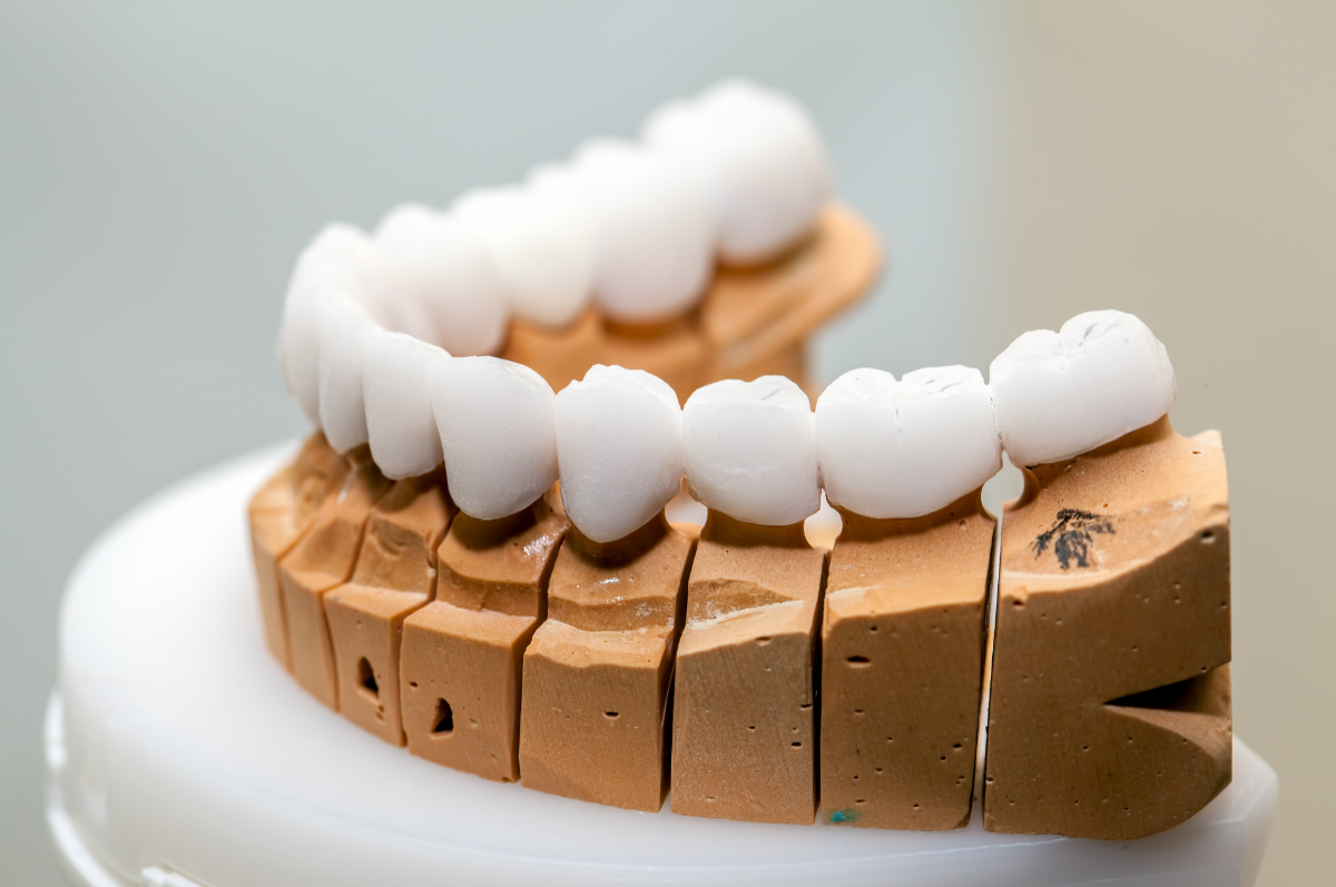 Ένθετα – Επένθετα – Υπερένθετα